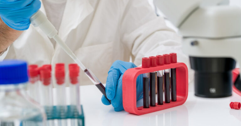 Un test de sânge ar putea detecta boala Parkinson înainte de apariția simptomelor