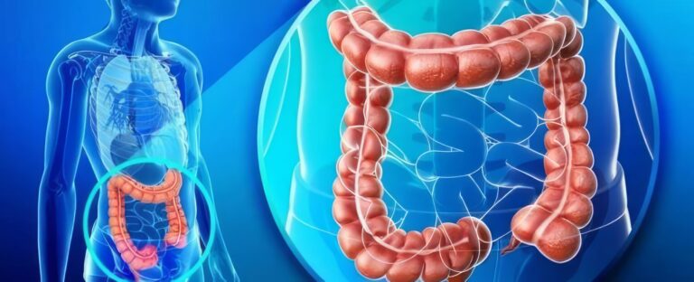 Cancerul colorectal: România face un pas decisiv spre diagnosticarea precoce cu ajutorul inteligenței artificiale